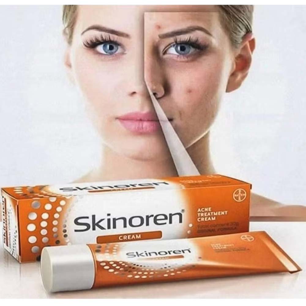 Skinoren Acne Treatment & Whitening Cream - 30g for All Skin Types, Azelaic Acid Formula for Clear, Even-Toned Skin