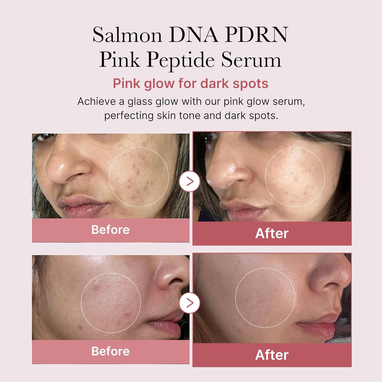 Medicube PDRN Pink Peptide Serum with Niacinamide for firming, hydrating & brightening skin tone. Korean glow serum.